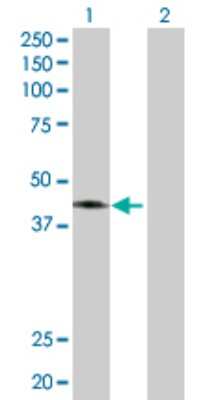 Western Blot: Calcium Activated Nucleotidase 1/CANT1 Antibody [H00124583-D01P] - Analysis of CANT1 expression in transfected 293T cell line by CANT1 polyclonal antibody.Lane 1: CANT1 transfected lysate(44.80 KDa).Lane 2: Non-transfected lysate.