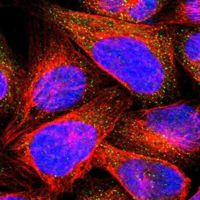 Immunocytochemistry/Immunofluorescence: Calcium-binding-protein-P22 Antibody [NBP1-87589] - Immunofluorescent staining of human cell line U-2 OS shows localization to vesicles.