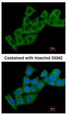 Immunocytochemistry/Immunofluorescence: Calcium-binding-protein-P22 Antibody [NBP2-53090] - Analysis of methanol-fixed HepG2, using Calcium binding protein P22 antibody at 1:200 dilution.