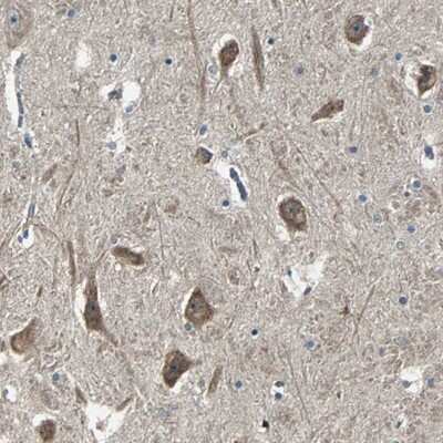 Immunohistochemistry-Paraffin: Calcium-binding-protein-P22 Antibody [NBP1-87589] - Staining of human hippocampus shows strong cytoplasmic and nuclear(nucleolar) positivity in neuronal cells.