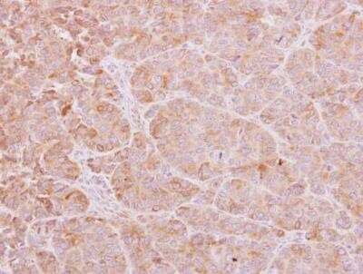 Immunohistochemistry-Paraffin: Calcium-binding-protein-P22 Antibody [NBP2-53090] - Internal detects Calcium binding protein P22 protein at cytoplasm on SW480 xenograft by immunohistochemical analysis. Sample: Paraffin-embedded SW480 xenograft. Calcium binding protein P22 antibody [N2C]