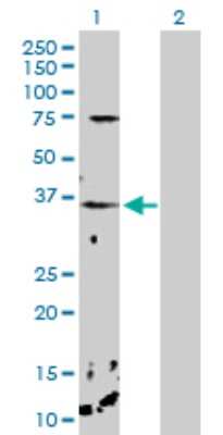 Western Blot: Calcium-binding-protein-P22 Antibody [H00011261-D01P] - Analysis of CHP expression in transfected 293T cell line by CHP polyclonal antibody.Lane 1: CHP transfected lysate(22.50 KDa).Lane 2: Non-transfected lysate.