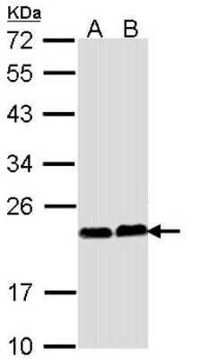 Western Blot: Calcium-binding-protein-P22 Antibody [NBP1-33736] - Sample (30 ug of whole cell lysate) A: Hela B: Hep G2 12% SDS PAGE; antibody diluted at 1:1000.