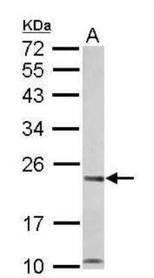 Western Blot: Calcium-binding-protein-P22 Antibody [NBP1-33736] - A. 50 ug rat liver lysate/extract 12 % SDS-PAGE