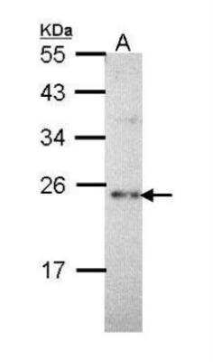 Western Blot: Calcium-binding-protein-P22 Antibody [NBP2-53090] - Sample (30 ug of whole cell lysate) A: Hep G2 12% SDS PAGE  diluted at 1:1000. 