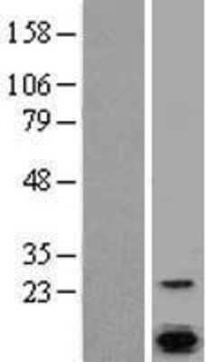 Western Blot: Calcium-binding-protein-P22 Overexpression Lysate (Adult Normal) [NBL1-09168] Left-Empty vector transfected control cell lysate (HEK293 cell lysate); Right -Over-expression Lysate for Calcium-binding-protein-P22.