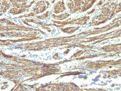 Immunohistochemistry-Paraffin: Caldesmon/CALD1 Antibody (CALD1/820 + h-CALD) - IHC-Prediluted [NBP2-48183] - Formalin-fixed, paraffin-embedded human Uterus stained with Caldesmon Monoclonal Antibody (CALD1/820 + h-CALD).
