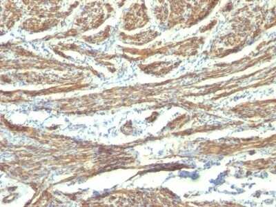 Immunohistochemistry-Paraffin: Caldesmon/CALD1 Antibody (CALD1/820 + h-CALD) [NBP2-44424] - Human Uterus stained with Caldesmon Monoclonal Antibody (CALD1/820 + h-CALD).