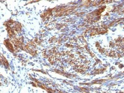 Immunohistochemistry-Paraffin: Caldesmon/CALD1 Antibody (CALD1/820) - Azide and BSA Free [NBP2-47818] - Human Uterus stained with Caldesmon Monoclonal Antibody (CALD1/820).