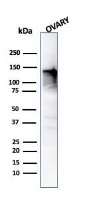 Western Blot: Caldesmon/CALD1 Antibody (CALD1/820) - Azide and BSA Free [NBP2-47818] - Western Blot Analysis of human Ovary tissue using Caldesmon/CALD1 antibody (CALD1/820).