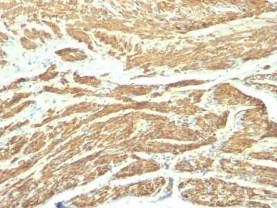 Immunohistochemistry-Paraffin: Caldesmon/CALD1 Antibody (SPM168) - Azide and BSA Free [NBP2-47817] - Human Uterus stained with Caldesmon Monoclonal Antibody (SPM168).