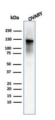 Western Blot: Caldesmon/CALD1 Antibody (SPM168) - Azide and BSA Free [NBP2-47817] - Western Blot Analysis of human Ovary tissue lysate using Caldesmon/CALD1 MAb (SPM168).