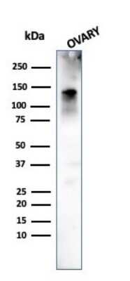 Western Blot: Caldesmon/CALD1 Antibody (h-CALD) - Azide and BSA Free [NBP2-47816] - Western Blot Analysis of human Ovary tissue using Caldesmon/CALD1 antibody (h-CALD).