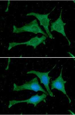 Immunocytochemistry/Immunofluorescence: Calmodulin Antibody (J4D8) [NBP1-04268] - Analysis in HeLa cells. The secondary antibody (green) was  Alexa Fluor 488. DAPI was stained the cell nucleus (blue).