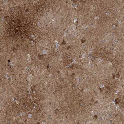 Immunohistochemistry-Paraffin Calneuron 1 Antibody