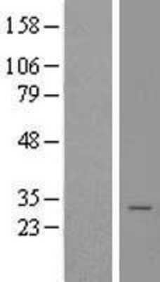 Western Blot Calneuron 1 Overexpression Lysate