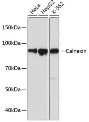 Western Blot: Calnexin Antibody (5S3U3) [NBP3-16490] - Western blot analysis of extracts of various cell lines, using Calnexin antibody (NBP3-16490) at 1:1000 dilution. Secondary antibody: HRP Goat Anti-Rabbit IgG (H+L) at 1:10000 dilution. Lysates/proteins: 25ug per lane. Blocking buffer: 3% nonfat dry milk in TBST. Detection: ECL Basic Kit. Exposure time: 30s.