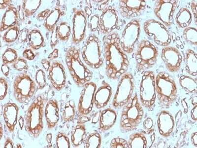 Immunohistochemistry-Paraffin: Calnexin Antibody (CANX/1543) [NBP2-79701] - Formalin-fixed, paraffin-embedded human Renal Cell Carcinoma stained with Calnexin Antibody (CANX/1543).