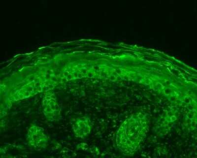 Immunohistochemistry: Calnexin Antibody [NBP2-12724] - Immunohistochemistry analysis using Rabbit Anti-Calnexin Polyclonal Antibody (NBP2-12724). Tissue: backskin. Species: Mouse. Fixation: Bouin's Fixative Solution. Primary Antibody: Rabbit Anti-Calnexin Polyclonal Antibody (NBP2-12724) at 1:100 for 1 hour at RT. Secondary Antibody: FITC Goat Anti-Rabbit (green) at 1:50 for 1 hour at RT.