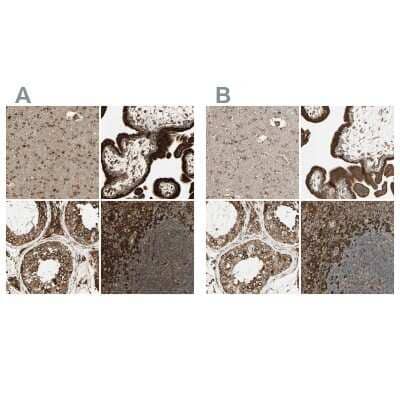 <b>Independent Antibodies Validation. </b>Immunohistochemistry-Paraffin: Calnexin Antibody [NBP1-85520] - Staining of human cerebral cortex, placenta, testis and tonsil using Anti-Calnexin antibody NBP1-85520 (A) shows similar protein distribution across tissues to independent antibody NBP1-85519 (B).