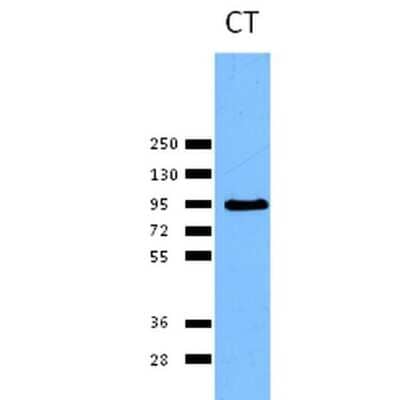Western Blot: Calnexin Antibody [NBP2-12724] - Western blot analysis of Human Cervical cancer cell line (HeLa) lysate showing detection of Calnexin protein using Rabbit Anti-Calnexin Polyclonal Antibody (NBP2-12724). Primary Antibody: Rabbit Anti-Calnexin Polyclonal Antibody (NBP2-12724) at 1:1000.