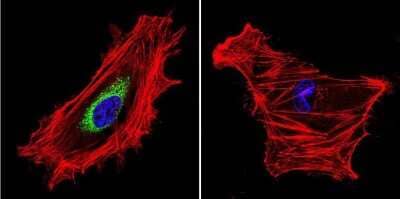 Immunocytochemistry/Immunofluorescence: Calpain 1 Antibody (156) [NB600-1404] - Analysis of Calpain in HeLa cells. Cells were grown on chamber slides and fixed with formaldehyde prior to staining. Cells were probed without (control) or with a Calpain monoclonal antibody at a dilution of 1:20 overnight at 4C, washed with PBS and incubated with a DyLight-488 conjugated secondary antibody. Calpain staining (green), F-Actin staining with Phalloidin (red) and nuclei with DAPI (blue) is shown. Images were taken at 60X magnification.