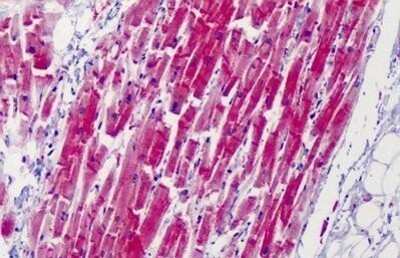 Immunohistochemistry-Paraffin: Calpain 1 Antibody (15C10) [NBP1-72013] - Analysis of anti-CAPN1 / Calpain 1 antibody with human heart at concentration 5 ug/ml.
