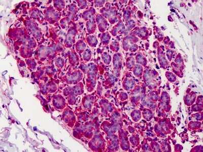 Immunohistochemistry-Paraffin: Calpain 1 Antibody (15C10) [NBP1-72013] - Analysis of anti-CAPN1 / Calpain 1 antibody with human breast at concentration 5 ug/ml.