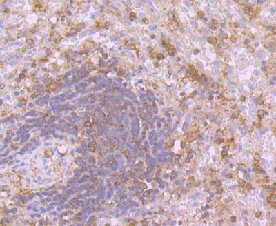 Immunohistochemistry: Calpain 1 Antibody (2A1) [NBP2-76952] - Immunohistochemical analysis of paraffin-embedded human spleen tissue using anti-Calpain 1 antibody. Counter stained with hematoxylin.