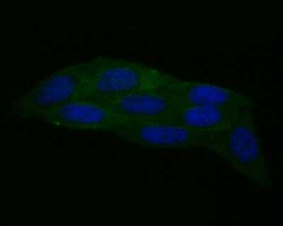Immunocytochemistry/Immunofluorescence: Calpain 1 Antibody (2A2) [NBP2-76963] - ICC staining Calpain 1(green) in SiHa cells. The nuclear counter stain is DAPI (blue). Cells were fixed in paraformaldehyde, permeabilised with 0.25% Triton X100/PBS.