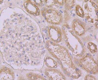 Immunohistochemistry: Calpain 1 Antibody (2A2) [NBP2-76963] - Immunohistochemical analysis of paraffin-embedded human kidney tissue using anti-Calpain 1 antibody. Counter stained with hematoxylin.