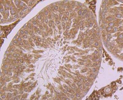 Immunohistochemistry: Calpain 1 Antibody (2A2) [NBP2-76963] - Immunohistochemical analysis of paraffin-embedded rat testis tissue using anti-Calpain 1 antibody. Counter stained with hematoxylin.