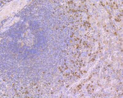Immunohistochemistry-Paraffin: Calpain 1 Antibody (2A2) [NBP2-76963] - Analysis of paraffin-embedded human spleen tissue using anti-Calpain 1 antibody. Counter stained with hematoxylin.