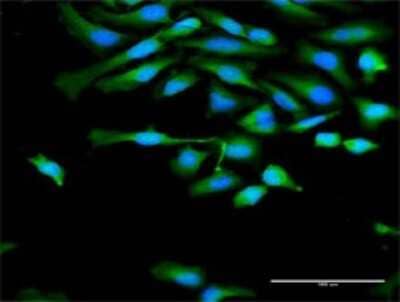 Immunocytochemistry/Immunofluorescence: Calpain 1 Antibody [H00000823-D01P] - Analysis of antibody to CAPN1 on HeLa cell. Antibody concentration 30 ug/ml.