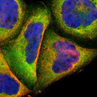 Immunocytochemistry/Immunofluorescence: Calpain 1 Antibody [NBP1-88205] - Immunofluorescent staining of human cell line A-431 shows localization to cytosol.