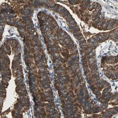 Immunohistochemistry-Paraffin: Calpain 1 Antibody [NBP1-88205] - Staining of human fallopian tube shows high expression.