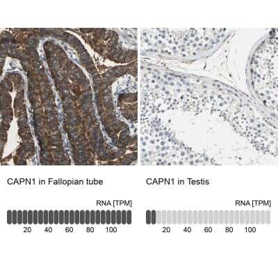 Immunohistochemistry-Paraffin Calpain 1 Antibody - BSA Free