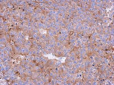 Immunohistochemistry-Paraffin: Calpain 1 Antibody [NBP2-15670] - Immunohistochemical analysis of paraffin-embedded PC13 xenograft, using antibody at 1:500 dilution.