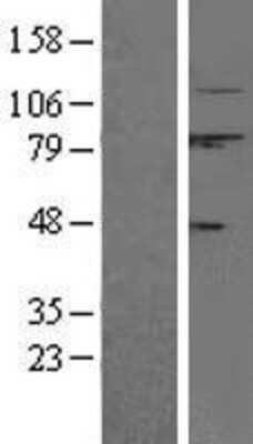 Western Blot: Calpain 1 Overexpression Lysate (Adult Normal) [NBL1-08677] Left-Empty vector transfected control cell lysate (HEK293 cell lysate); Right -Over-expression Lysate for Calpain 1.