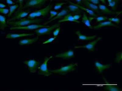 Immunocytochemistry/ Immunofluorescence Calpain 10 Antibody