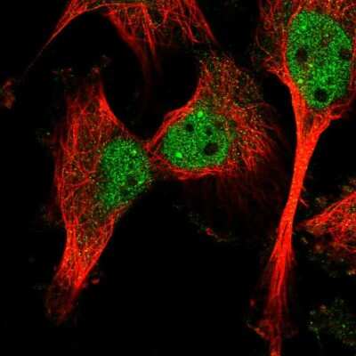Immunocytochemistry/ Immunofluorescence Calpain 10 Antibody - BSA Free