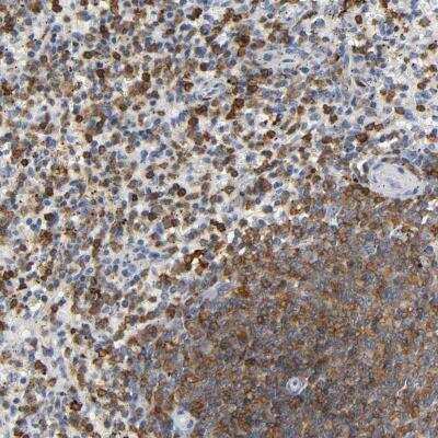 Immunohistochemistry Calpain 10 Antibody - BSA Free