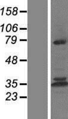 Western Blot Calpain 10 Overexpression Lysate