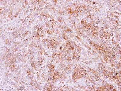 Immunohistochemistry-Paraffin Calpain 11 Antibody - BSA Free