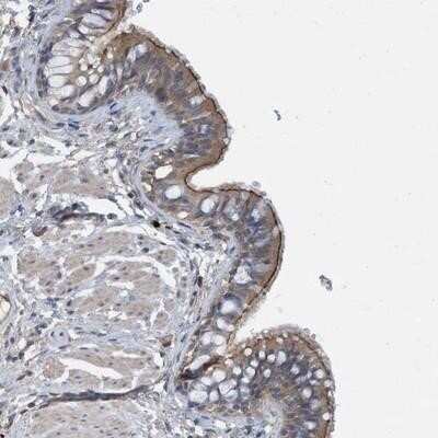 Immunohistochemistry-Paraffin Calpain 13 Antibody - BSA Free