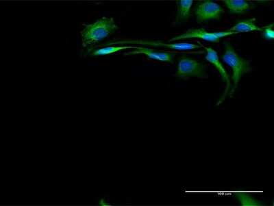 Immunocytochemistry/Immunofluorescence: Calpain 2 Antibody [H00000824-D01P] - Analysis of antibody to CAPN2 on HeLa cell. Antibody concentration 20 ug/ml.