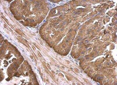 Immunohistochemistry-Paraffin: Calpain 2 Antibody [NBP2-15675] - Paraffin-embedded mouse prostate. Calpain 2 antibody [N2C1], Internal dilution: 1:500.