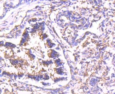 Immunohistochemistry-Paraffin: Calpain 2 Antibody (JA43-41) [NBP2-67202] - Analysis of paraffin-embedded human lung tissue using anti-Calpain 2 antibody. Counter stained with hematoxylin.