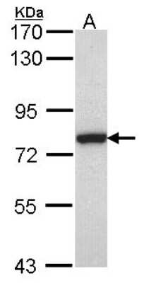 Western Blot: Calpain 2 Antibody [NBP2-15675] - Sample (30 ug of whole cell lysate) A: JurKat 7. 5% SDS PAGE gel, diluted at 1:1000.
