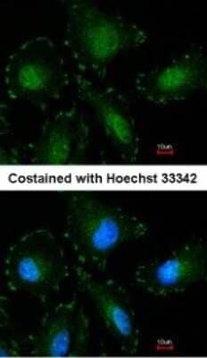 Immunocytochemistry/ Immunofluorescence Calpain 5 Antibody